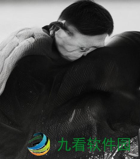 淑芬两腿间又痒又疼的原因分析二腿之间痒疼怎么回事